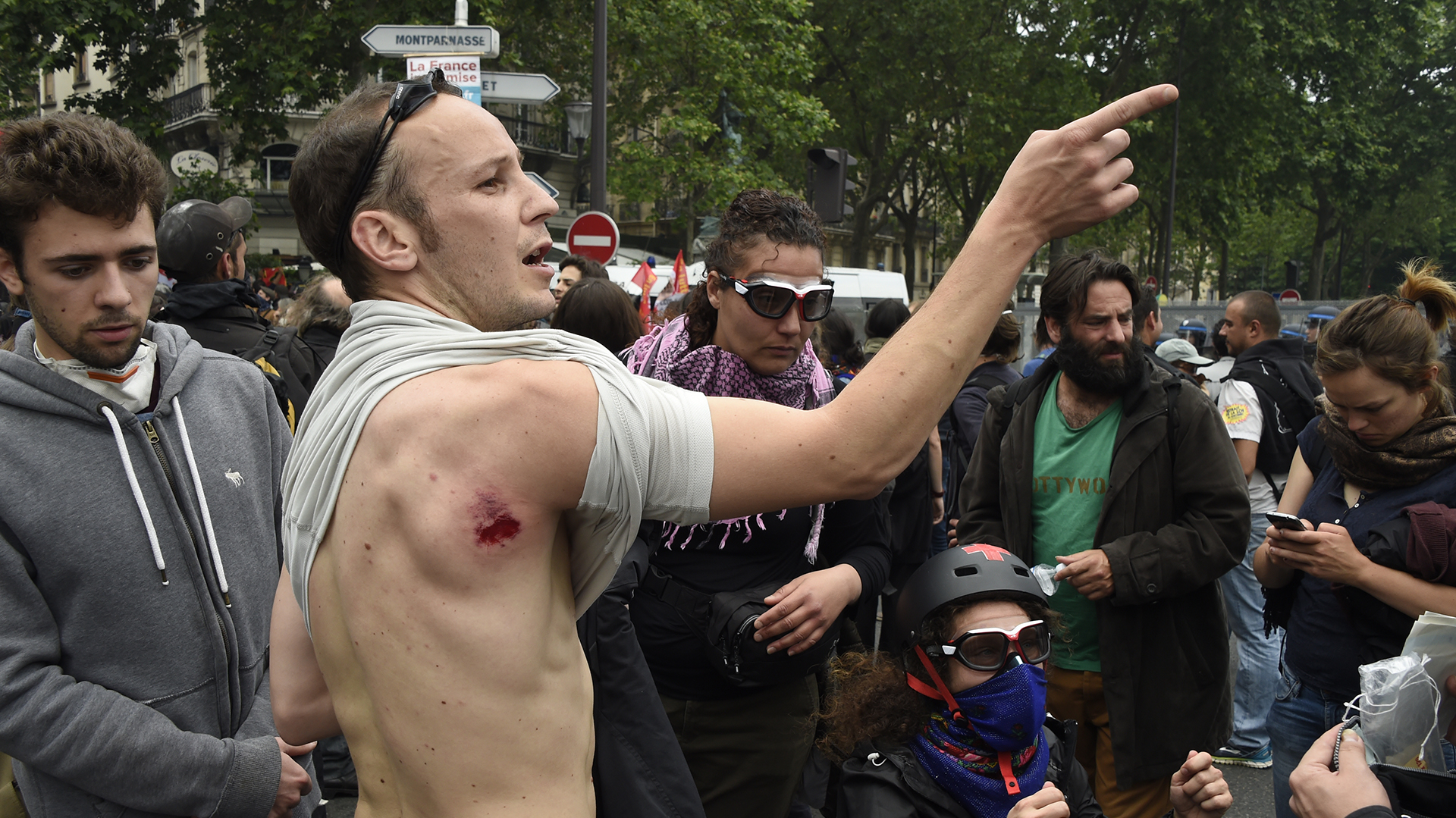 An injured protester gestures during a demonstration against proposed labour reforms in Paris on June 14, 2016.  Strikes closed the Eiffel Tower and disrupted transport in France on June 14 as tens of thousands prepared to march against labour reforms with the Euro 2016 football championship in full swing.  / AFP PHOTO / DOMINIQUE FAGET