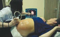 test-prenatal